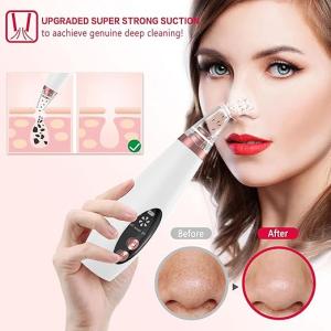Blackhead Remover Instrument Black Dot Remover Acne Vacuum- Blackhead Remover